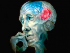 Ученые близки к решению проблемы болезни Альцгеймера.
