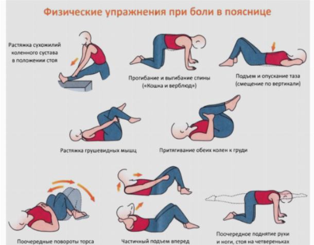 Рис.: упражнения для лечения поясничного остеохондроза