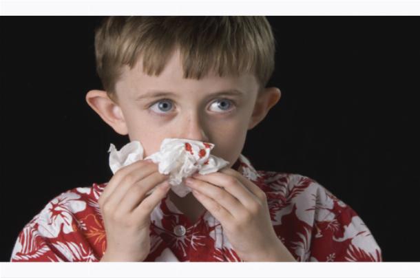 Кровь из носа: причины и первая помощь Подробнее