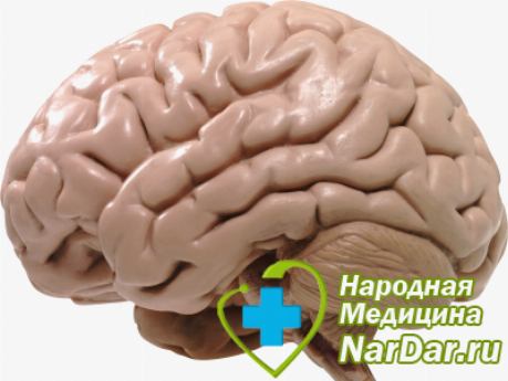 Симптомы и признаки аневризм головного мозга