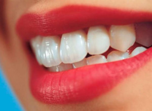 2.1прямые-реставрвции-зубов