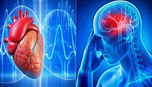 Энцефалопатия различного генеза: причины, признаки и пути коррекции